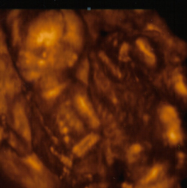 3d ultrasound photos. August 22, 2005 ultrasound of